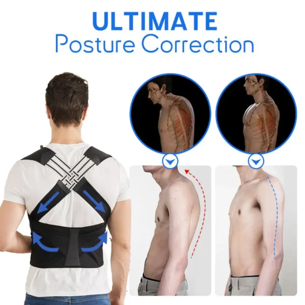 SUPTRUCK™ Tourmaline Infrared Posture Corrector