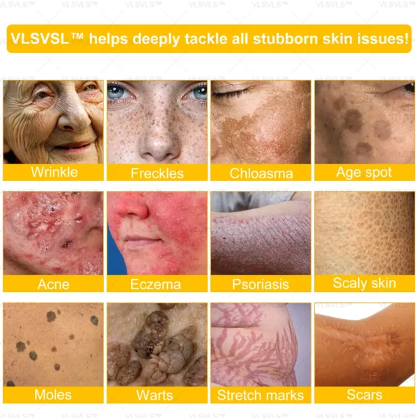 VLSVLS™ Bee Venom Skin Restoration Cream