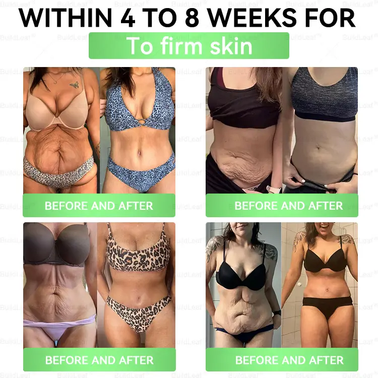 ๐ ๐ซ๐บ๐ฎ๐ ๐๐ฒ๐ฎ๐น | ๐๐ฎ๐ข๐ฅ๐๐๐๐๐ยฎ ๐๐๐-๐ ๐-๐ข๐ง-๐ ๐๐ฅ๐ข๐ฆ & ๐๐๐๐ฅ๐ญ๐ก๐ฒ ๐๐ซ๐๐ฅ ๐๐จ๐ฅ๐ฎ๐ญ๐ข๐จ๐ง (๐๐๐๐ ๐ ๐๐๐ฆ, ๐ฃ๐๐ ๐๐๐๐ ๐๐๐ ๐ข๐๐ก๐ ๐๐ 7 ๐๐๐ฆ๐ ) โ
๐ฆ๐๐ฝ๐ฝ๐ผ๐ฟ๐๐ ๐ผ๐ฏ๐ฒ๐๐ถ๐๐, ๐ฐ๐ฎ๐ฟ๐ฑ๐ถ๐ผ๐๐ฎ๐๐ฐ๐๐น๐ฎ๐ฟ ๐ต๐ฒ๐ฎ๐น๐๐ต, ๐ฑ๐ถ๐ฎ๐ฏ๐ฒ๐๐ฒ๐, ๐๐น๐ฒ๐ฒ๐ฝ ๐ฎ๐ฝ๐ป๐ฒ๐ฎ, ๐ด๐๐ ๐ต๐ฒ๐ฎ๐น๐๐ต, ๐ท๐ผ๐ถ๐ป๐ ๐ถ๐๐๐๐ฒ๐, ๐ฐ๐ก๐ข๐ฅ๐ ๐๐ฅ๐ฌ๐จ ๐๐ข๐ซ๐ฆ๐ข๐ง๐ ๐ญ๐ก๐ ๐ฌ๐ค๐ข๐ง ๐๐ง๐ ๐๐จ๐จ๐ฌ๐ญ๐ข๐ง๐ ๐๐ง๐๐ซ๐ ๐ฒ.