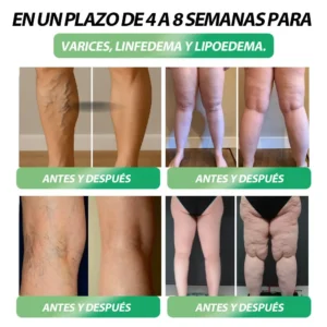 ๐๐ฎ๐ข๐ฅ๐๐๐๐๐ยฎ ๐ฎ๐ณ๐ท-1 ๐
๐ข๐ญ & ๐๐ข๐ญ๐๐ฅ 8 en 1 ๐๐จ๐ฅ๐ฎ๐๐ขรณ๐ง ๐๐ซ๐๐ฅโจ (Solo una vez al dรญa, cambios visibles en 7 dรญas) Para obesidad, salud cardiovascular, diabetes, apnea del sueรฑo, salud intestinal, problemas articulares y mรกs