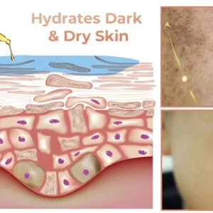 2025s,NESLEMY™ Fast Dark Spot Remover ✨ Where science meets luxury. Our melanin-correcting serum erase