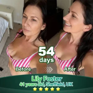 Change from the inside out 🔮𝚆𝚊𝚛𝚖𝙵𝚊𝚖𝚒𝚕𝚢®𝐶𝑜𝑙𝑙𝑎𝑔𝑒𝑛 𝑃𝑒𝑝𝑡𝑖𝑑𝑒 & 𝑆𝑡𝑒𝑚 𝐶𝑒𝑙𝑙 𝑂𝑟𝑎𝑙 𝚂𝚎𝚛𝚞𝚖🔮(Lift & Firm Sagging Skin & Reduce Wrinkle Formation)🪄