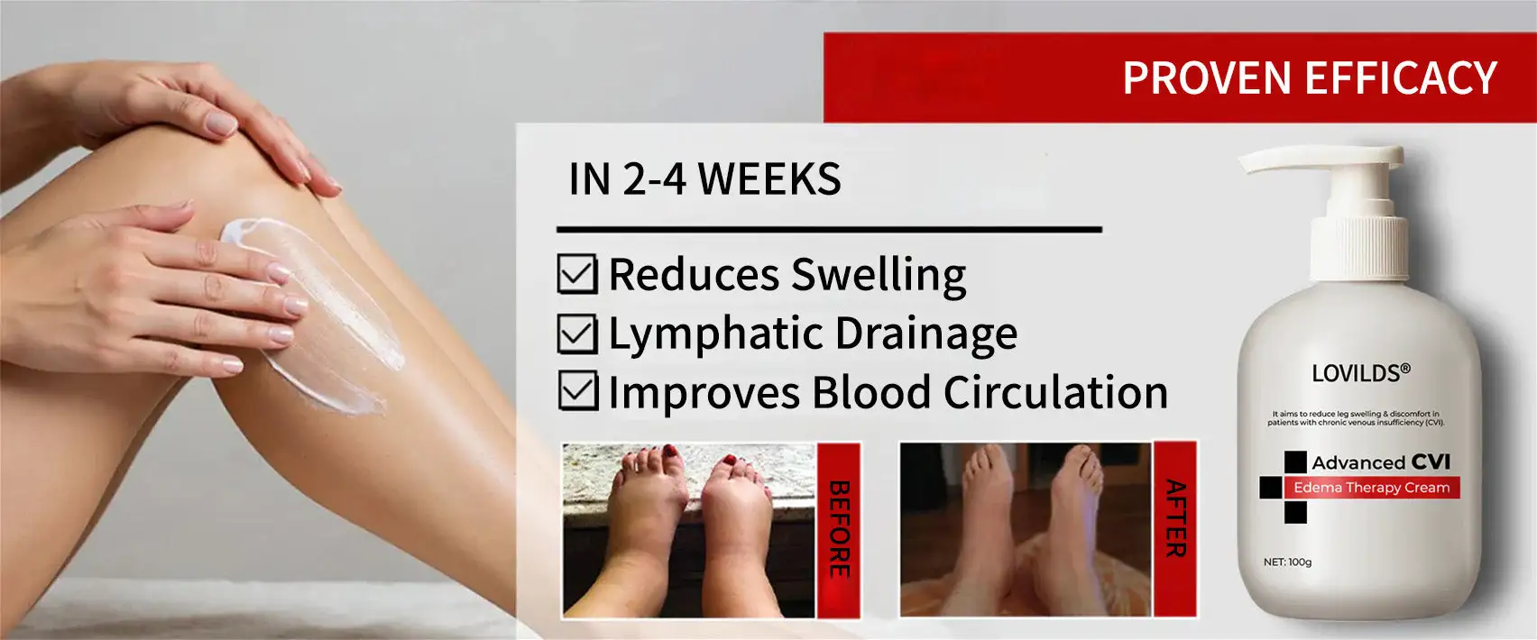 LOVILDS® Advanced CVI Edema Restorative Cream