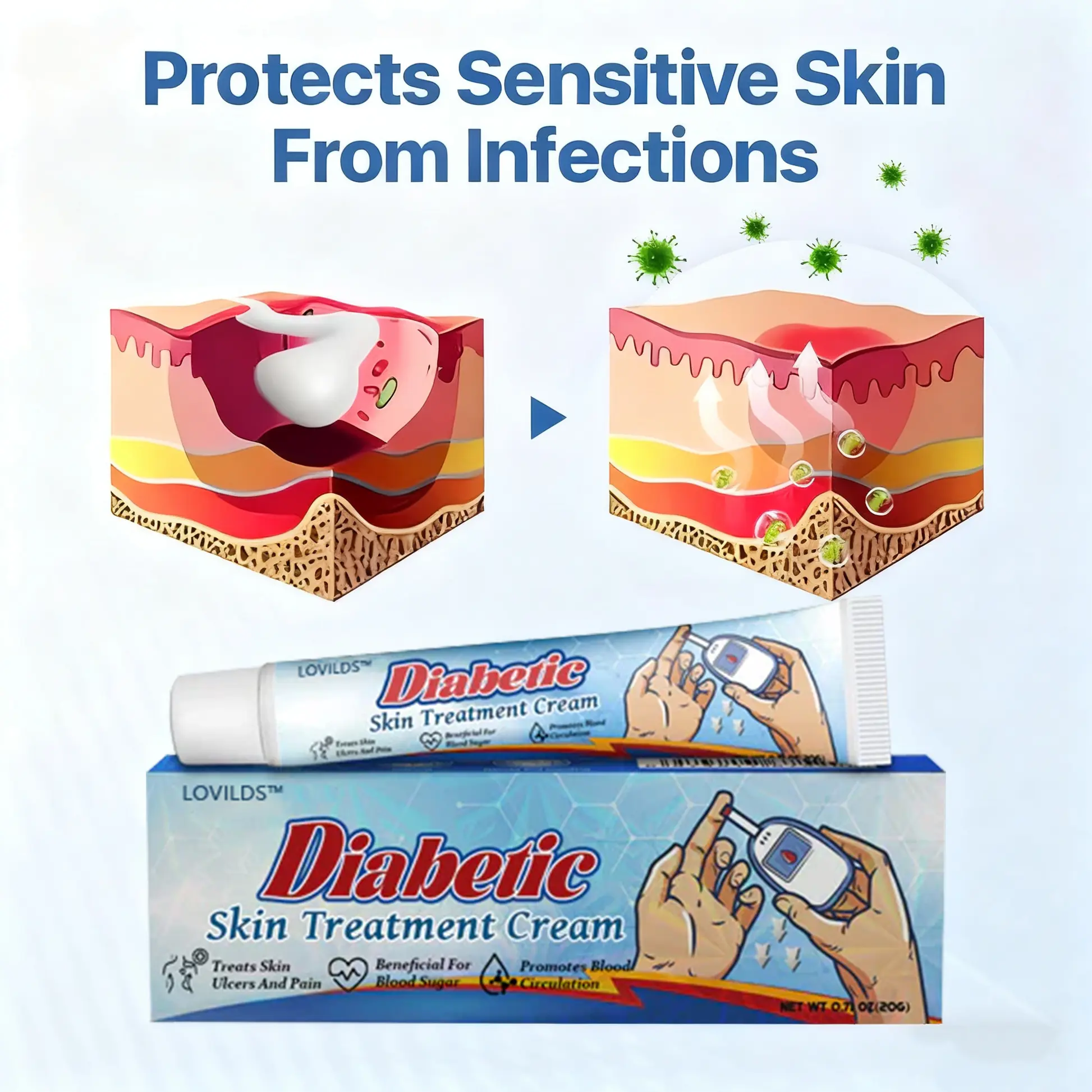 LOVILDS™ Diabetic Skin Treatment Cream,Diabetics, This Cream Could Save Your Feet