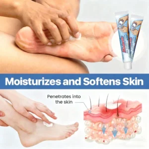 LOVILDS™ Diabetic Skin Treatment Cream,Diabetics, This Cream Could Save Your Feet