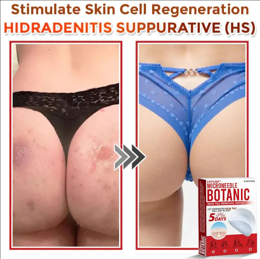 LOVILDS™ Removal Patch