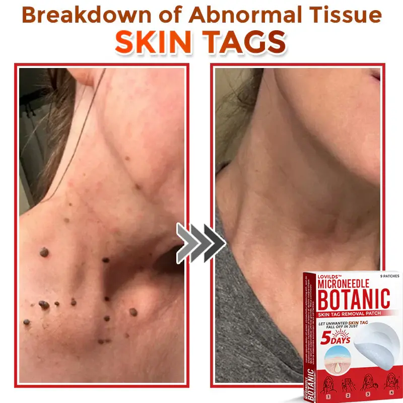 LOVILDS™ Removal Patch