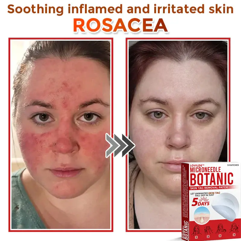 LOVILDS™ Removal Patch