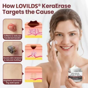 Lovilds®KeraErase Dual-Action Renewal Cream