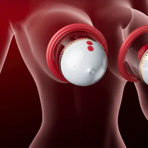 💥New on sale 2026 💞 LOVILDS™ Kiss of an Angel – Breast Masturbator with Suction & Licking Stimulation for Women