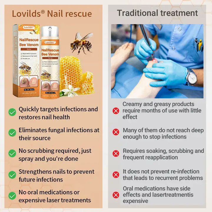 【Oficiální vlajkový obchod】Lovilds® NailRescue Včelí jed ve spreji✅✅
