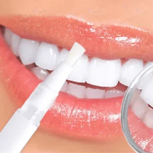 Skavix™ Teeth Whitening Pen