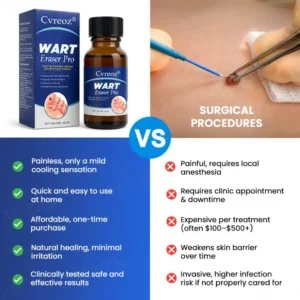 🔥Warts No More - 50% OFF | Cvreoz® Wart Eraser Pro (Copy)