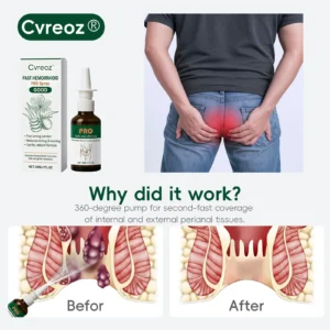 🎅 𝘾𝙝𝙧𝙞𝙨𝙩𝙢𝙖𝙨 𝙎𝙖𝙡𝙚 | Cvreoz® Fast Hemorrhoid PRO Spray