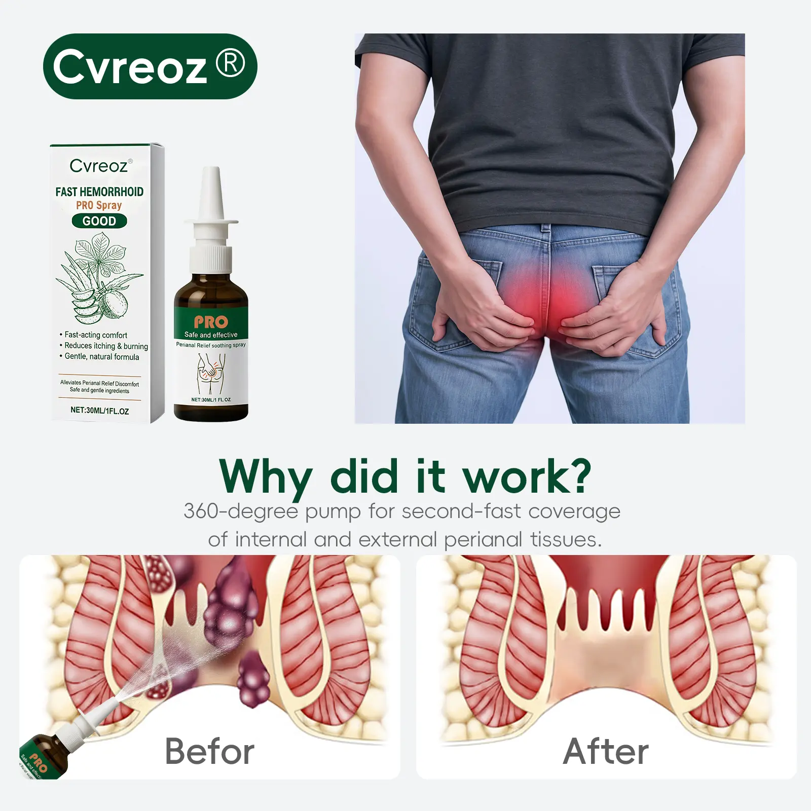 🎅 𝘾𝙝𝙧𝙞𝙨𝙩𝙢𝙖𝙨 𝙎𝙖𝙡𝙚 | Cvreoz® Fast Hemorrhoid PRO Spray