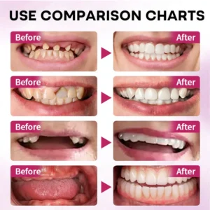 🦷 LOVILDSFirmHold Denture Adhesive — Up to 15 Days of Slip-Free Hold🦷