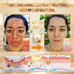 Cheemex® Bee Venom Skin Restoration Cream