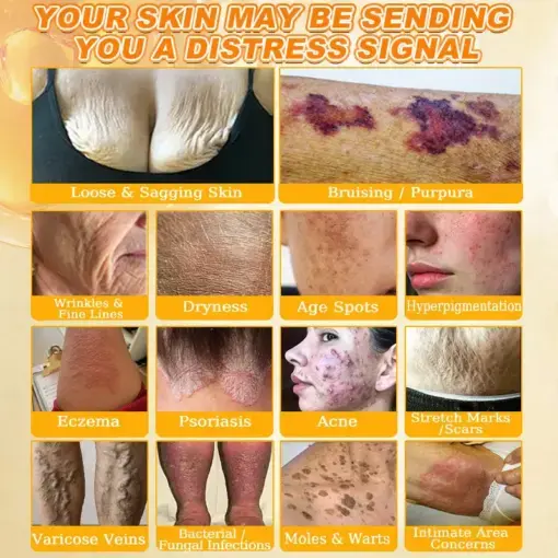 Cheemex® Bee Venom Skin Restoration Cream