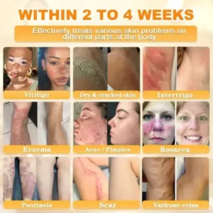 Cheemex® Bee Venom Skin Restoration Cream