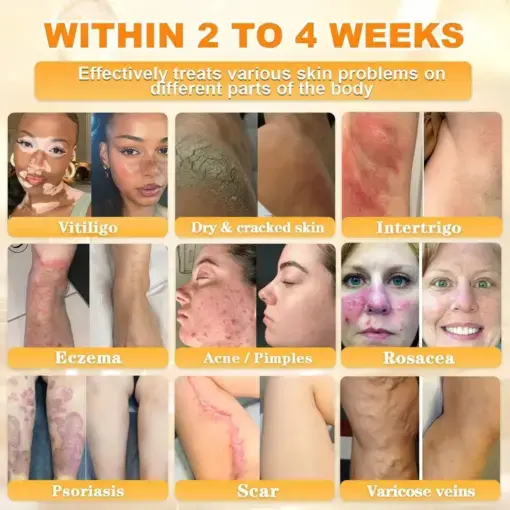 Cheemex® Bee Venom Skin Restoration Cream