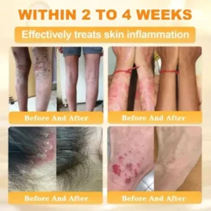 Cheemex® Bee Venom Skin Restoration Cream