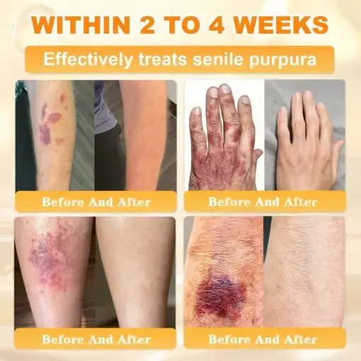 Cheemex® Bee Venom Skin Restoration Cream