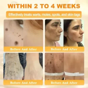 Cheemex® Bee Venom Skin Restoration Cream