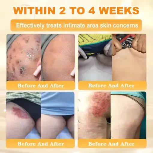 Cheemex® Bee Venom Skin Restoration Cream