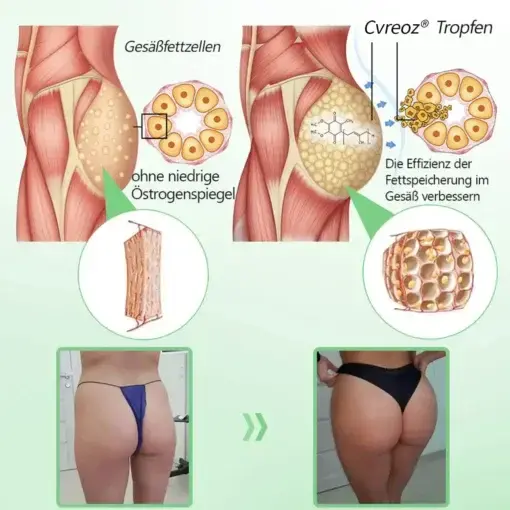 Cvreoz® 𝗬𝗼𝘂𝐭𝐡𝐆𝗹𝗼𝘄 𝑺𝒕𝙖𝙢𝙢𝙯𝙚𝒍𝒍𝒆𝒏 𝙆𝙤𝒍𝒍𝒂𝙜𝙚𝒏 𝗧𝗿𝗼𝒑𝐟𝙚𝙣