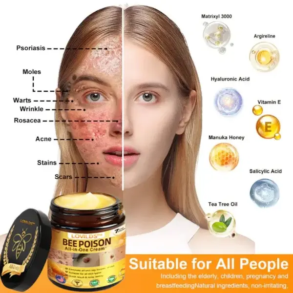 LOVILDS™ 𝐁𝐞𝐞 Poison 𝐀𝐥𝐥-𝐢𝐧-𝐎𝐧𝐞 𝐂𝐫𝐞𝐚𝐦