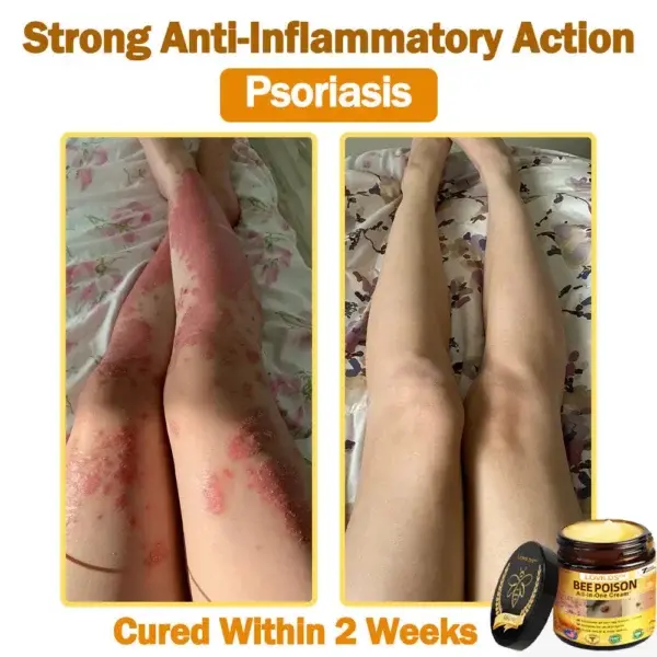 LOVILDS™ 𝐁𝐞𝐞 Poison 𝐀𝐥𝐥-𝐢𝐧-𝐎𝐧𝐞 𝐂𝐫𝐞𝐚𝐦