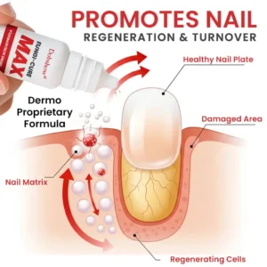LOVILDS Fungi-Cure Max 🎯 Triple-Action Formula: Penetrates Deep to the Nail Root, Eradicates Fungus & Restores Healthy Growth