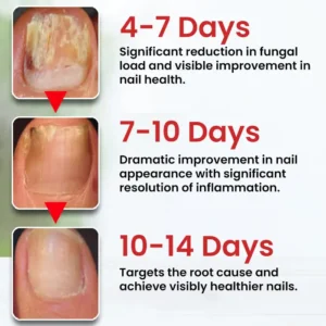 LOVILDS Fungi-Cure Max 🎯 Triple-Action Formula: Penetrates Deep to the Nail Root, Eradicates Fungus & Restores Healthy Growth