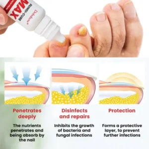 LOVILDS Fungi-Cure Max 🎯 Triple-Action Formula: Penetrates Deep to the Nail Root, Eradicates Fungus & Restores Healthy Growth