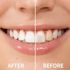 Smileasego™ — Instantly Whiter Smile🦷