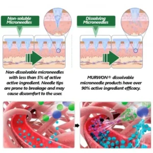 ๐ด๐๐ฅ๐ฆ๐๐ยฎ โ ๐ฉ๐๐๐๐๐ง๐๐ฃ๐ ๐๐๐ฏ๐๐ง๐๐๐ ๐๐๐ฃ๐ค-๐ด๐๐๐๐๐๐๐๐
๐๐ ๐ท๐๐ฉ๐๐ ๐๐๐๐๐ฃ๐ค๐ก๐ค๐๐ฎ