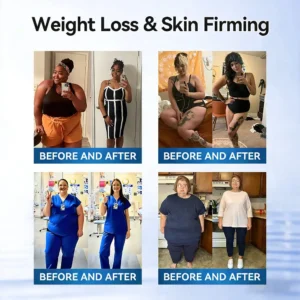 🇺🇸𝑶𝒇𝒇𝒊𝒄𝒊𝒂𝒍 𝑺𝒕𝒐𝒓𝒆  | 👩‍⚕️ LOVILDS®· 𝗕𝗲𝗿𝗯𝐞𝐫𝐢𝐧𝙚 × 𝙉𝑨𝑫+ 𝟏𝟎-𝙞𝙣-𝟏 𝘼𝒅𝒗𝒂𝒏𝒄𝒆𝐝 𝐍𝐚𝐧𝙤 𝙈𝙞𝙘𝙧𝙤𝙣𝒆𝒆𝒅𝒍𝐞 𝐏𝐚𝐭𝙘𝙝(𝐉𝐮𝐬𝐭 𝐨𝐧𝐜𝐞 𝐚 𝐝𝐚𝐲, 𝐯𝐢𝐬𝐢𝐛𝐥𝐞 𝐜𝐡𝐚𝐧𝐠𝐞𝐬 𝐢𝐧 𝟕 𝐝𝐚𝐲𝐬） ✅ 𝐅𝐨𝐫 𝐨𝐛𝐞𝐬𝐢𝐭𝐲, 🅛🅞🅞🅢🅔 🅢🅚🅘🅝,𝐝𝐢𝐚𝐛𝐞𝐭𝐞𝐬, 𝐬𝐥𝐞𝐞𝐩 𝐚𝐩𝐧𝐞𝐚, 𝐣𝐨𝐢𝐧𝐭 𝐢𝐬𝐬𝐮𝐞𝐬, 𝐚𝐧𝐝 𝐦𝐨𝐫𝐞