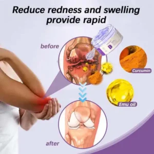 ✅ Official store: LOVILDS™ Turmeric & Emu Oil Arthritis Soothing Massage Gel(👨‍⚕️AAD Recommended)