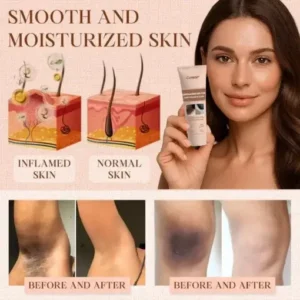 Cvreoz® Purifying Exfoliating Gel for Acanthosis Nigricans, Exfoliation, Dark Spots, Skin Tags, and Eczema