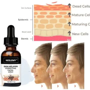 🔥Final 3 hours 60% off: ✨Fast Dark Spot Remover-NESLEMY™ Melanin Correcting Facial Serum!