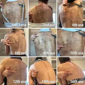 🔥Final 3 hours 60% off: ✨Fast Dark Spot Remover-NESLEMY™ Melanin Correcting Facial Serum!