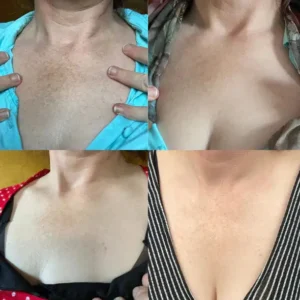 🔥Final 3 hours 60% off: ✨Fast Dark Spot Remover-NESLEMY™ Melanin Correcting Facial Serum!