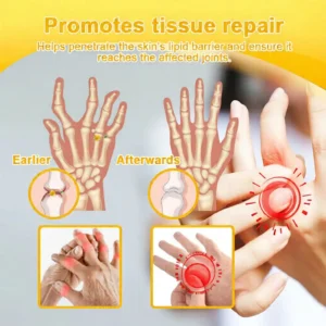 LOVILDS™  Bee Venom  Pain-Relief Bone Healing Cream 🎉🎉(Specially for older adults)