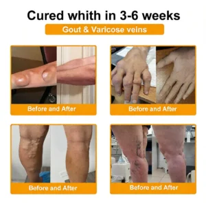 LOVILDS™  Bee Venom  Pain-Relief Bone Healing Cream 🎉🎉(Specially for older adults)