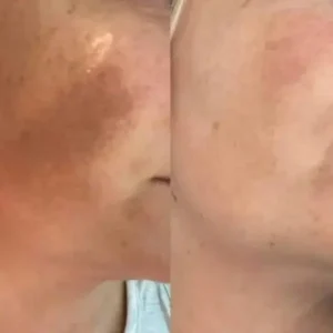 LOVILDS™ Facial Cream with 7% Arbutin + 4% Tranexamic Acid