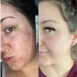 LOVILDS™ Facial Cream with 7% Arbutin + 4% Tranexamic Acid