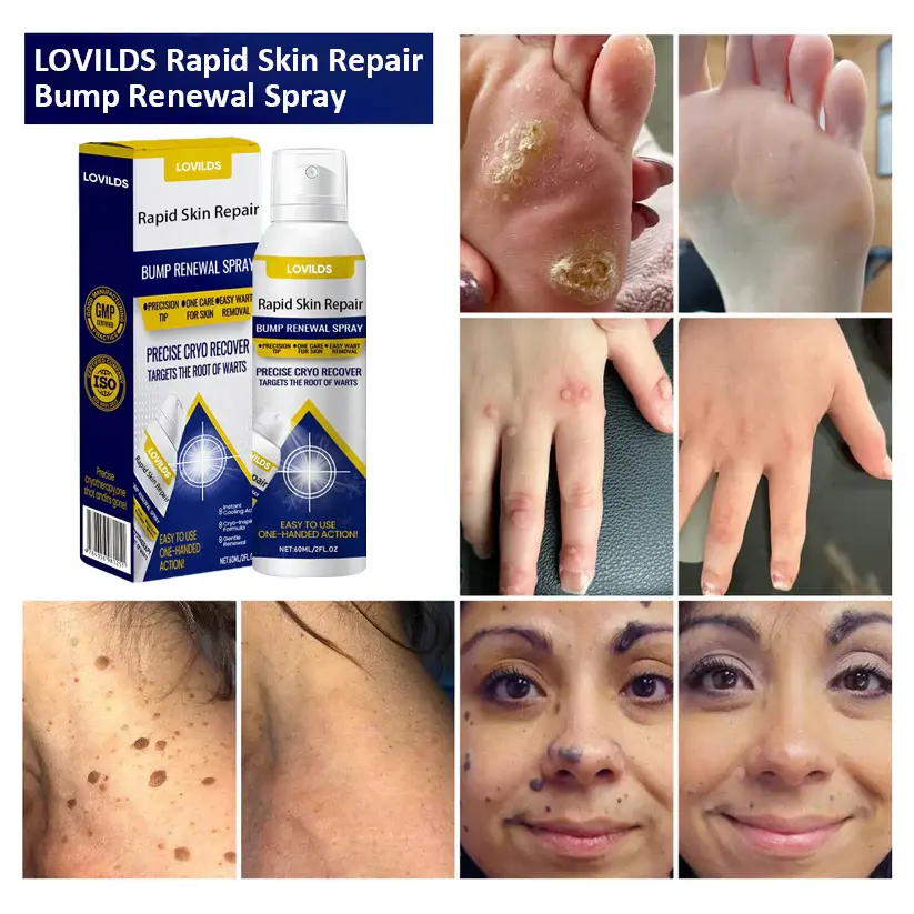 LOVILDS™Rapid Skin Repair & Bump Removal Spray