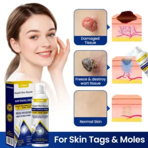 LOVILDS™Rapid Skin Repair & Bump Removal Spray