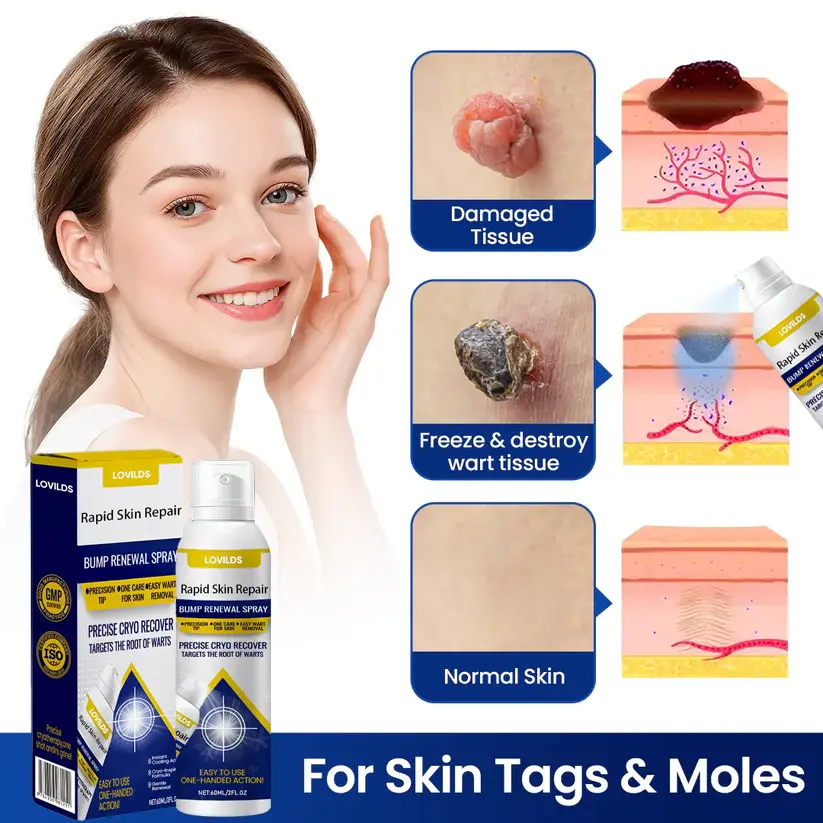 LOVILDS™Rapid Skin Repair & Bump Removal Spray