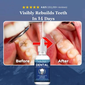 Smileasego Fluoride-Free Hydroxyapatite Tooth Armor Drops & Enamel Repair, Whitening